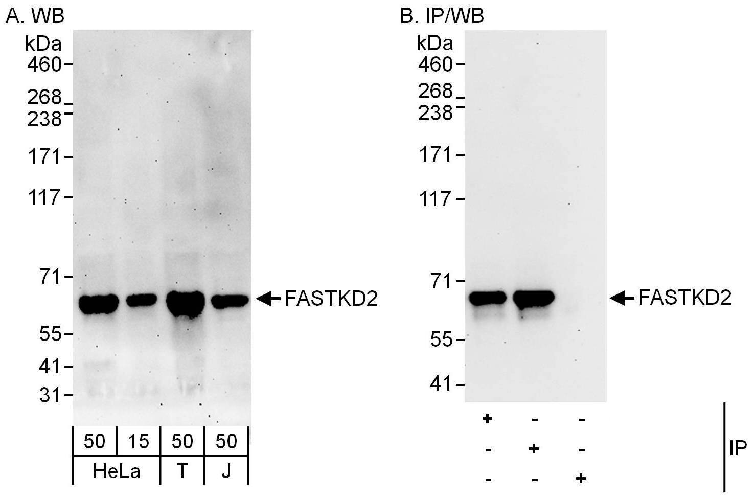 Western Blot FASTKD2 Antibody - BSA Free