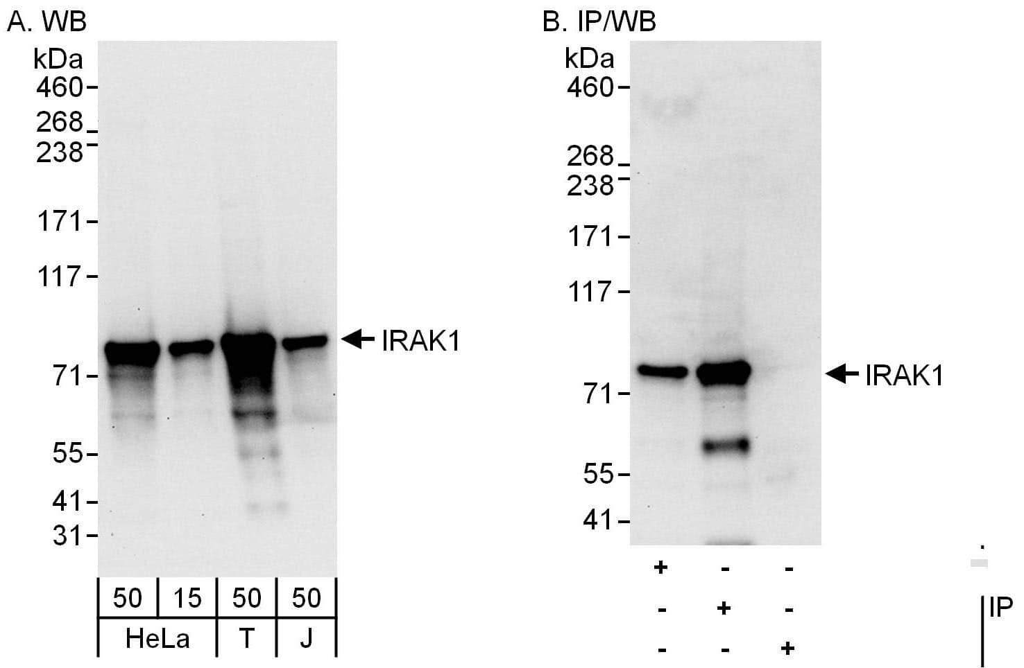 Western Blot:[NBP3-29886]-Detection of human IRAK1 by western blot and immunoprecipitation. Samples: Whole cell lysate from HeLa , HEK293T and Jurkat cells. Antibodies: Affinity purified rabbit anti-IRAK1 antibody used for WB at 0. 1 µg/ml and 1 µg/ml and used for IP at 6 µg/mg lysate. IRAK1 was also immunoprecipitated by rabbit anti-IRAK1 antibody , which recognizes an upstream epitope. Detection: Chemiluminescence with exposure times of 10 seconds.