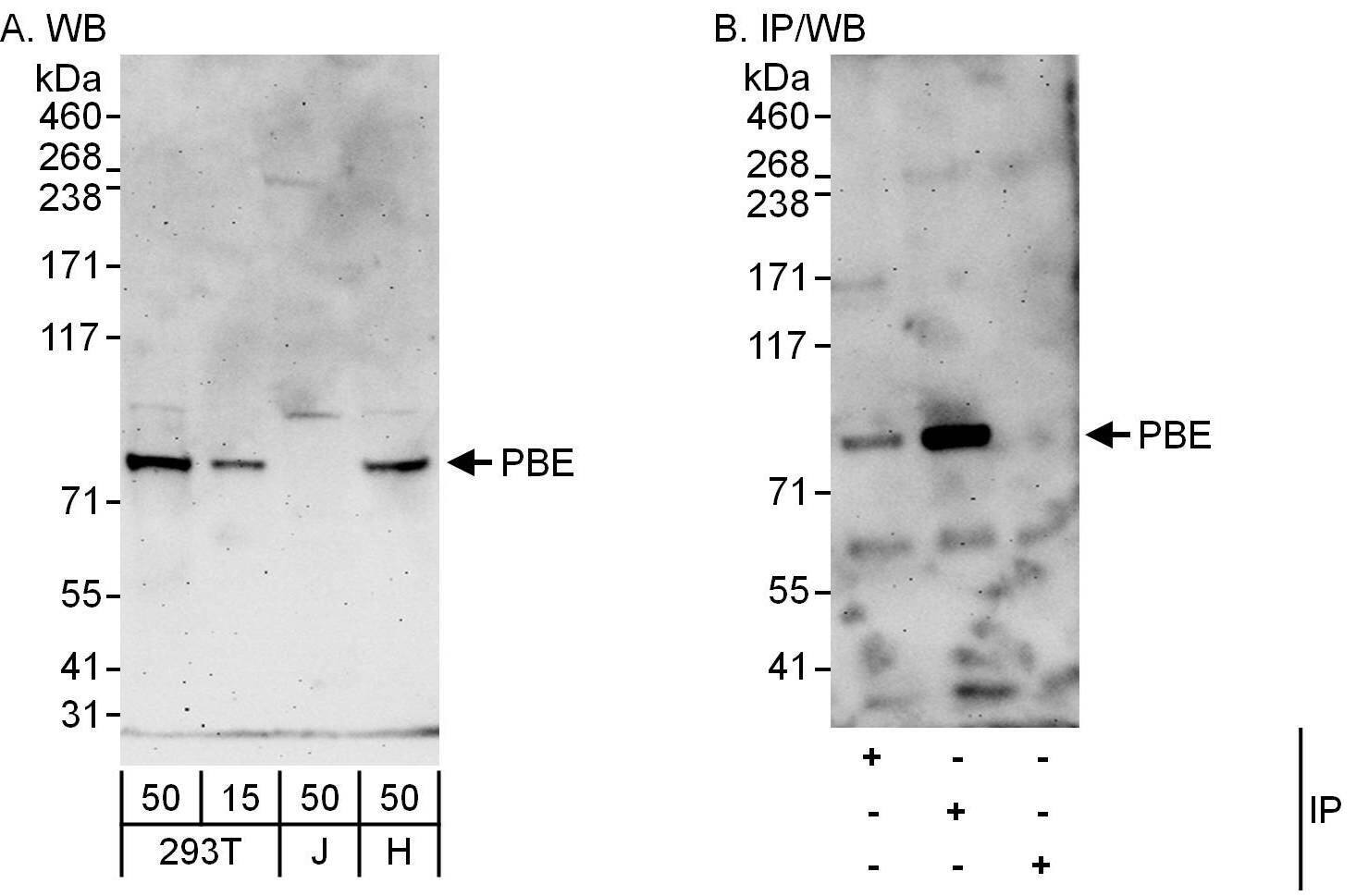 Western Blot:[NBP3-29887]-Detection of human PBE by western blot and immunoprecipitation. Samples: Whole cell lysate from HEK293T , Jurkat and HeLa cells. Antibodies: Affinity purified rabbit anti-PBE antibody used for WB at 0. 4 µg/ml and 1 µg/ml and used for IP at 6 µg/mg lysate. PBE was also immunoprecipitated by rabbit anti-PBE antibody , which recognizes an upstream epitope. Detection: Chemiluminescence with exposure times of 3 minutes.