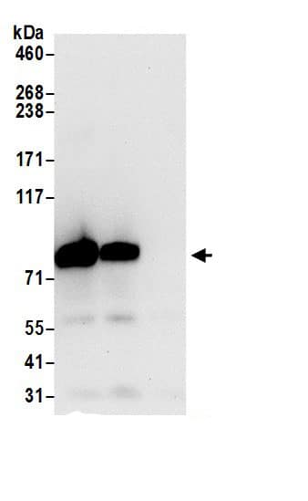 Immunoprecipitation:TARS AntibodyNBP3-29888] -Detection of human TARS by western blot of immunoprecipitates. Samples: Whole cell lysate (0.5 or 1.0 mg per IP reaction; 20% of IP loaded) from 293T cells prepared using NETN lysis buffer. Antibodies: Affinity purified rabbit anti-TARS antibody NBP3-29888 (lot NBP3-29888-1) used for IP at 6 µg per reaction. TARS was also immunoprecipitated by rabbit anti-TARS.. For blotting immunoprecipitated TARS, NBP3-29888 was used at 0.4 µg/ml. Detection: Chemiluminescence with an exposure time of 10 seconds.