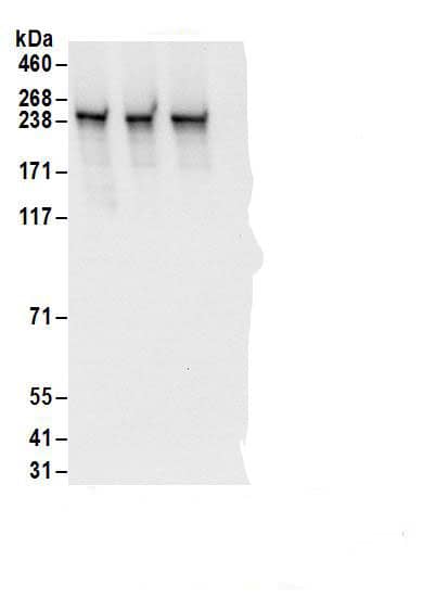 Immunoprecipitation:RRBP1 AntibodyNBP3-29889] -Detection of human RRBP1 by western blot of immunoprecipitates. Samples: Whole cell lysate (1 mg for IP; 20% of IP loaded) from HeLa cells. Antibodies: Affinity purified rabbit anti-RRBP1 antibody NBP3-29889 (lot NBP3-29889-1) used for IP at 6 µg/mg lysate. RRBP1 was also immunoprecipitated by rabbit anti-RRBP1 antibodies. For blotting immunoprecipitated RRBP1, NBP3-29889 was used at 1 µg/ml. Detection: Chemiluminescence with an exposure time of 3 seconds.