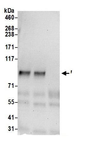 Immunoprecipitation:MTSS1L AntibodyNBP3-29890] -Detection of human MTSS1L by western blot of immunoprecipitates. Samples: Whole cell lysate (0.5 or 1.0 mg per IP reaction; 20% of IP loaded) from 293T cells prepared using NETN lysis buffer. Antibodies: Affinity purified rabbit anti-MTSS1L antibody NBP3-29890 (lot NBP3-29890-1) used for IP at 6 µg per reaction. MTSS1L was also immunoprecipitated by rabbit anti-MTSS1L antibody BL18253. For blotting immunoprecipitated MTSS1L, NBP3-29890 was used at 0.4 µg/ml. Detection: Chemiluminescence with an exposure time of 30 seconds.
