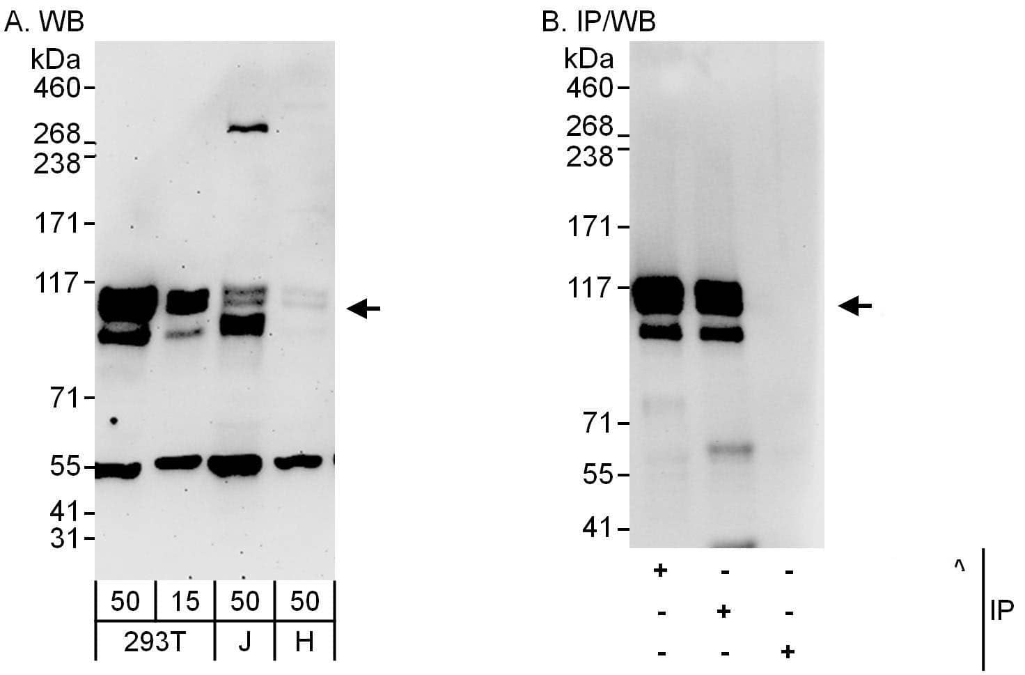 Western Blot:[NBP3-29891]-Detection of human c-Ski by western blot and immunoprecipitation. Samples: Whole cell lysate from HEK293T , Jurkat and HeLa cells. Antibodies: Affinity purified rabbit anti-c-Ski antibody used for WB at 0. 04 µg/ml and 1 µg/ml and used for IP at 6 µg/mg lysate. c-Ski was also immunoprecipitated by rabbit anti-c-Ski antibody , which recognizes an upstream epitope. Detection: Chemiluminescence with exposure times of 3 minutes and 10 seconds.