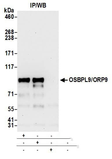 Immunoprecipitation:[NBP3-29894]-Detection of human OSBPL9/ORP9 by western blot of immunoprecipitates. Samples: Whole cell lysate from 293T cells prepared using NETN lysis buffer. Antibodies: Affinity purified rabbit anti-OSBPL9/ORP9 antibody used for IP at 6 µg per reaction. OSBPL9/ORP9 was also immunoprecipitated by rabbit anti-OSBPL9/ORP9 antibody. For blotting immunoprecipitated OSBPL9/ORP9, was used at 0. 4 µg/ml. Detection: Chemiluminescence with an exposure time of 30 seconds.