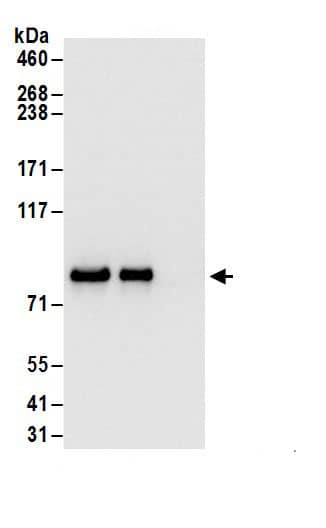 Immunoprecipitation:Glycogen Synthase AntibodyNBP3-29895] -Detection of human GYS1 by western blot of immunoprecipitates. Samples: Whole cell lysate (1 mg for IP; 20% of IP loaded) from 293T cells. Antibodies: Affinity purified rabbit anti-GYS1 antibody NBP3-29895 (lot NBP3-29895-1) used for IP at 6 µg/mg lysate. GYS1 was also immunoprecipitated by rabbit anti-GYS1.. For blotting immunoprecipitated GYS1, NBP3-29895 was used at 1 µg/ml. Detection: Chemiluminescence with an exposure time of 3 seconds.