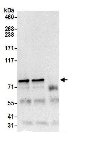 Immunoprecipitation:CD2AP AntibodyNBP3-29896] -Detection of human CD2AP by western blot of immunoprecipitates. Samples: Whole cell lysate (0.5 or 1.0 mg per IP reaction; 20% of IP loaded) from 293T cells prepared using NETN lysis buffer. Antibodies: Affinity purified rabbit anti-CD2AP antibody NBP3-29896 (lot NBP3-29896-1) used for IP at 6 µg per reaction. CD2AP was also immunoprecipitated by rabbit anti-CD2AP antibody BL18416. For blotting immunoprecipitated CD2AP, NBP3-29896 was used at 0.4 µg/ml. Detection: Chemiluminescence with an exposure time of 30 seconds.