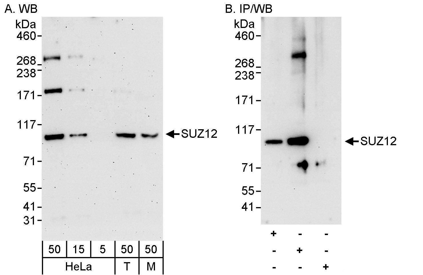 Western Blot:[NBP3-29897]-Detection of human and mouse SUZ12 by western blot and immunoprecipitation. Samples: Whole cell lysate from HeLa , HEK293T , and mouse NIH 3T3 cells. Antibodies: Affinity purified rabbit anti-SUZ12 antibody used for WB at 0. 04 µg/ml and 1 µg/ml and used for IP at 3 µg/mg lysate. SUZ12 was also immunoprecipitated by rabbit anti-SUZ12 antibody BL8750, which recognizes an upstream epitope. Detection: Chemiluminescence with exposure times of 3 minutes and 30 seconds.