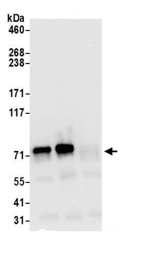 Immunoprecipitation:GARS AntibodyNBP3-29898] -Detection of human GARS by western blot of immunoprecipitates. Samples: Whole cell lysate (0.5 or 1.0 mg per IP reaction; 20% of IP loaded) from 293T cells prepared using NETN lysis buffer. Antibodies: Affinity purified rabbit anti-GARS antibody NBP3-29898 (lot NBP3-29898-1) used for IP at 6 µg per reaction. GARS was also immunoprecipitated by rabbit anti-GARS antibody. For blotting immunoprecipitated GARS, NBP3-29898 was used at 0.4 µg/ml. Detection: Chemiluminescence with an exposure time of 10 seconds.