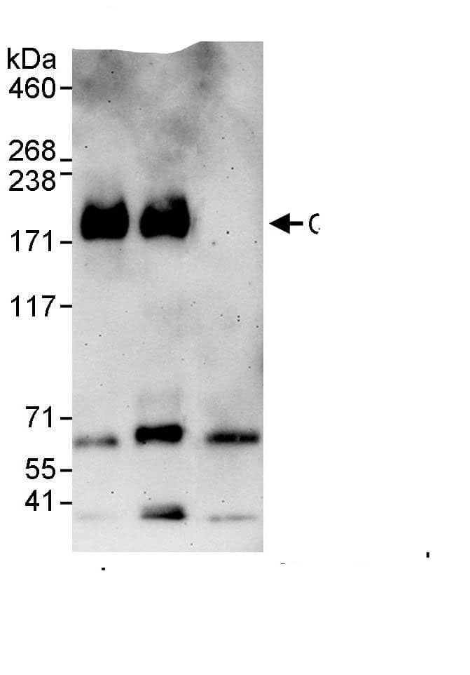 Immunoprecipitation:SIK3 AntibodyNBP3-29899] -Detection of human QSK by western blot of immunoprecipitates. Samples: Whole cell lysate (1 mg for IP, 20% of IP loaded) from HeLa cells. Antibodies: Affinity purified rabbit anti-QSK antibody NBP3-29899 used for IP at 3 µg/mg lysate. QSK was also immunoprecipitated by rabbit anti-QSK., which recognizes a downstream epitope. For blotting immunoprecipitated QSK, A302-455A was used at 1 µg/ml. Detection: Chemiluminescence with an exposure time 3 minutes.