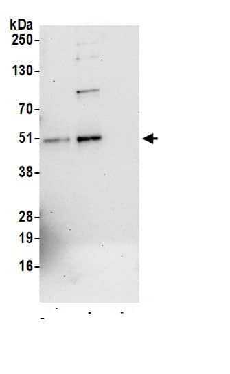 Immunoprecipitation:TC-PTP/PTPN2 AntibodyNBP3-29903] -Detection of human PTPN2 by western blot of immunoprecipitates. Samples: Whole cell lysate (0.5 or 1.0 mg per IP reaction; 20% of IP loaded) from HeLa cells prepared using NETN lysis buffer. Antibodies: Affinity purified rabbit anti-PTPN2 antibody NBP3-29903 (lot NBP3-29903-1) used for IP at 6 µg per reaction. PTPN2 was also immunoprecipitated by rabbit anti-PTPN2.. For blotting immunoprecipitated PTPN2, NBP3-29903 was used at 1 µg/ml. Detection: Chemiluminescence with an exposure time of 75 seconds.