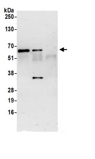 Immunoprecipitation:IFIT3 AntibodyNBP3-29904] -Detection of human IFIT3 by western blot of immunoprecipitates. Samples: Whole cell lysate (0.5 or 1.0 mg per IP reaction; 20% of IP loaded) from HeLa cells prepared using NETN lysis buffer. Antibodies: Affinity purified rabbit anti-IFIT3 antibody NBP3-29904 (lot NBP3-29904-1) used for IP at 6 µg per reaction. IFIT3 was also immunoprecipitated by rabbit anti-IFIT3.. For blotting immunoprecipitated IFIT3, NBP3-29904 was used at 1 µg/ml. Detection: Chemiluminescence with an exposure time of 10 seconds.