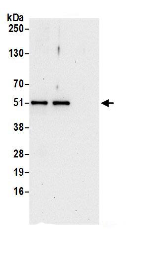 Immunoprecipitation:ETEA AntibodyNBP3-29905] -Detection of human FAF2 by western blot of immunoprecipitates. Samples: Whole cell lysate (0.5 or 1.0 mg per IP reaction; 20% of IP loaded) from 293T cells prepared using NETN lysis buffer. Antibodies: Affinity purified rabbit anti-FAF2 antibody NBP3-29905 (lot NBP3-29905-1) used for IP at 6 µg per reaction. FAF2 was also immunoprecipitated by rabbit anti-FAF2.. For blotting immunoprecipitated FAF2, NBP3-29905 was used at 0.4 µg/ml. Detection: Chemiluminescence with an exposure time of 30 seconds.