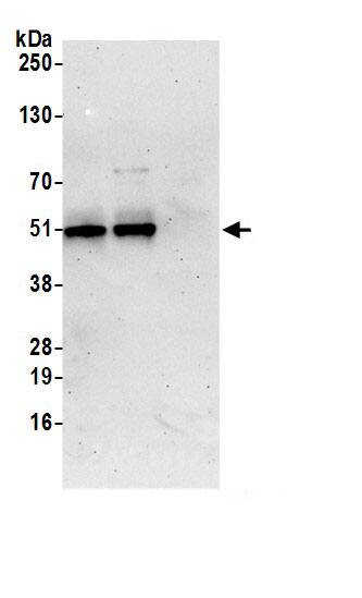 Immunoprecipitation:TAPP1/PLEKHA1 AntibodyNBP3-29906] -Detection of human PLEKHA1 by western blot of immunoprecipitates. Samples: Whole cell lysate (0.5 or 1.0 mg per IP reaction; 20% of IP loaded) from Jurkat cells prepared using NETN lysis buffer. Antibodies: Affinity purified rabbit anti-PLEKHA1 antibody NBP3-29906 (lot NBP3-29906-1) used for IP at 6 µg per reaction. PLEKHA1 was also immunoprecipitated by rabbit anti-PLEKHA1.. For blotting immunoprecipitated PLEKHA1, NBP3-29906 was used at 1 µg/ml. Detection: Chemiluminescence with an exposure time of 3 minutes.