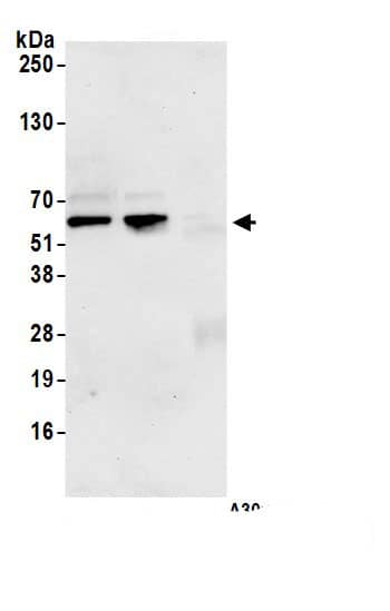Immunoprecipitation:CDK8 AntibodyNBP3-29908] -Detection of human CDK8 by western blot of immunoprecipitates. Samples: Whole cell lysate (1.0 mg per IP reaction; 20% of IP loaded) from HEK293T cells prepared using NETN lysis buffer. Antibodies: Affinity purified rabbit anti-CDK8 antibody NBP3-29908 (lot NBP3-29908-2) used for IP at 6 µg per reaction. CDK8 was also immunoprecipitated by a previous lot of this antibody (lot NBP3-29908-1). For blotting immunoprecipitated CDK8, NBP3-29908 was used at 1 µg/ml. Detection: Chemiluminescence with an exposure time of 10 seconds.