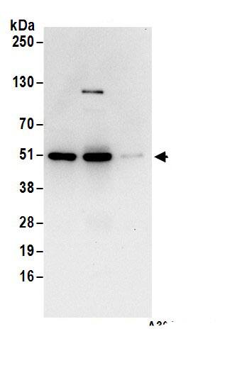 Immunoprecipitation:CSK AntibodyNBP3-29909] -Detection of human CSK by western blot of immunoprecipitates. Samples: Whole cell lysate (1 mg for IP; 20% of IP loaded) from Jurkat cells. Antibodies: Affinity purified rabbit anti-CSK antibody NBP3-29909 (lot NBP3-29909-1) used for IP at 6 µg/mg lysate. CSK was also immunoprecipitated by rabbit anti-CSK.. For blotting immunoprecipitated CSK,  was used at 1 µg/ml. Detection: Chemiluminescence with an exposure time of 10 seconds.