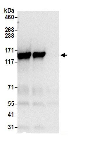 Immunoprecipitation:Tripeptidyl peptidase II AntibodyNBP3-29910] -Detection of human TPP2 by western blot of immunoprecipitates. Samples: Whole cell lysate (0.5 or 1.0 mg per IP reaction; 20% of IP loaded) from 293T cells prepared using NETN lysis buffer. Antibodies: Affinity purified rabbit anti-TPP2 antibody NBP3-29910 (lot NBP3-29910-1) used for IP at 6 µg per reaction. TPP2 was also immunoprecipitated by rabbit anti-TPP2.. For blotting immunoprecipitated TPP2,  was used at 0.4 µg/ml. Detection: Chemiluminescence with an exposure time of 10 seconds.
