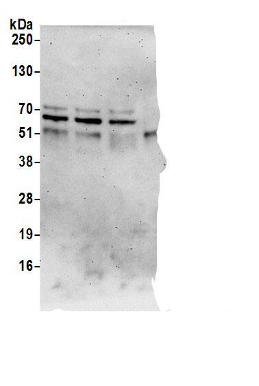 Immunoprecipitation:SPATS2L AntibodyNBP3-29911] -Detection of human SPATS2L by western blot of immunoprecipitates. Samples: Whole cell lysate (0.5 or 1.0 mg per IP reaction; 20% of IP loaded) from 293T cells prepared using NETN lysis buffer. Antibodies: Affinity purified rabbit anti-SPATS2L antibody NBP3-29911 (lot NBP3-29911-1) used for IP at 6 µg per reaction. SPATS2L was also immunoprecipitated by rabbit anti-SPATS2L antibodies A305-118A and A305-152A For blotting immunoprecipitated SPATS2L, A305-118A was used at 0.1 µg/ml. Detection: Chemiluminescence with an exposure time of 3 minutes.