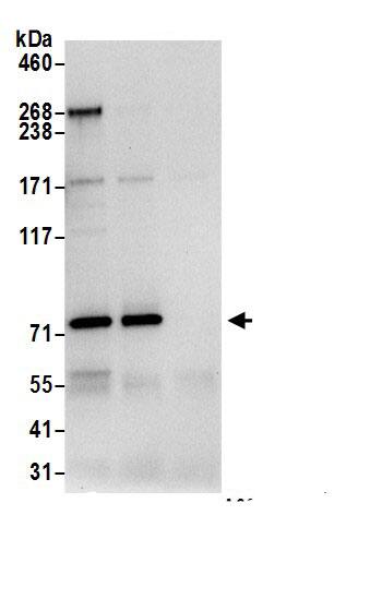 Immunoprecipitation:DPP3 AntibodyNBP3-29912] -Detection of human DPP3 by western blot of immunoprecipitates. Samples: Whole cell lysate (0.5 or 1.0 mg per IP reaction; 20% of IP loaded) from 293T cells prepared using NETN lysis buffer. Antibodies: Affinity purified rabbit anti-DPP3 antibody NBP3-29912 (lot NBP3-29912-1) used for IP at 6 µg per reaction. DPP3 was also immunoprecipitated by rabbit anti-DPP3.. For blotting immunoprecipitated DPP3, NBP3-29912 was used at 1 µg/ml. Detection: Chemiluminescence with an exposure time of 10 seconds.