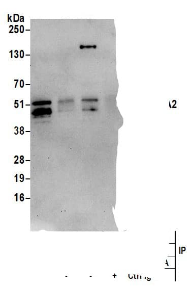 Immunoprecipitation:Cyclin A2 AntibodyNBP3-29913] -Detection of human CCNA2 by western blot of immunoprecipitates. Samples: Whole cell lysate (0.5 or 1.0 mg per IP reaction; 20% of IP loaded) from Jurkat cells prepared using NETN lysis buffer. Antibodies: Affinity purified rabbit anti-CCNA2 antibody NBP3-29913 (lot NBP3-29913-1) used for IP at 6 µg per reaction. CCNA2 was also immunoprecipitated by rabbit anti-CCNA2 antibodies for blotting immunoprecipitated CCNA2, NBP3-29913 was used at 1 µg/ml. Detection: Chemiluminescence with an exposure time of 30 seconds.