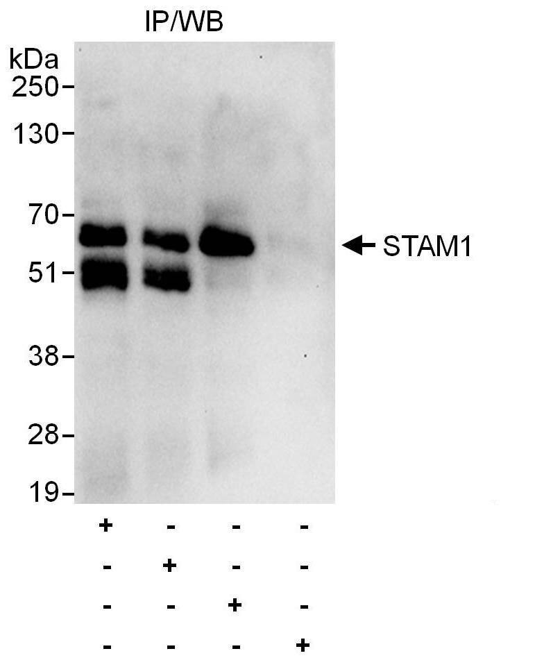 Immunoprecipitation:[NBP3-29916]-Detection of human STAM1 by western blot of immunoprecipitates. Samples: Whole cell lysate from HeLa cells. Antibodies: Affinity purified rabbit anti-STAM1 antibody used for IP at 6 µg/mg lysate. STAM1 was also immunoprecipitated by rabbit anti-STAM1 antibodies and , which recognize other epitopes. For blotting immunoprecipitated STAM1, was used at 1 µg/ml. Detection: Chemiluminescence with an exposure time of 10 seconds.