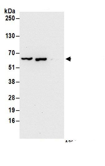 Immunoprecipitation:DYNC1LI1 AntibodyNBP3-29917] -Detection of human DYNC1LI1 by western blot of immunoprecipitates. Samples: Whole cell lysate (1 mg for IP; 20% of IP loaded) from HeLa cells. Antibodies: Affinity purified rabbit anti-DYNC1LI1 antibody NBP3-29917 (lot NBP3-29917-1) used for IP at 6 µg/mg lysate. DYNC1LI1 was also immunoprecipitated by rabbit anti-DYNC1LI1.. For blotting immunoprecipitated DYNC1LI1, NBP3-29917 was used at 0.1 µg/ml. Detection: Chemiluminescence with an exposure time of 30 seconds.