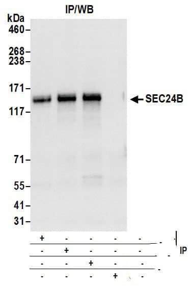 Immunoprecipitation:[NBP3-29918]-Detection of human SEC24B by western blot of immunoprecipitates. Samples: Whole cell lysate from 293T cells prepared using NETN lysis buffer. Antibodies: Affinity purified rabbit anti-SEC24B antibody used for IP at 6 µg per reaction. SEC24B was also immunoprecipitated by rabbit anti-SEC24B antibodies and. For blotting immunoprecipitated SEC24B, was used at 0. 4 µg/ml. Detection: Chemiluminescence with an exposure time of 3 seconds.