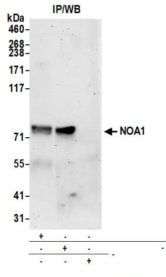Immunoprecipitation:[NBP3-29919]-Detection of human NOA1 by western blot of immunoprecipitates. Samples: Whole cell lysate from 293T cells prepared using NETN lysis buffer. Antibodies: Affinity purified rabbit anti-NOA1 antibody used for IP at 6 µg per reaction. NOA1 was also immunoprecipitated by rabbit anti-NOA1 antibody. For blotting immunoprecipitated NOA1, was used at 1 µg/ml. Detection: Chemiluminescence with an exposure time of 3 minutes.