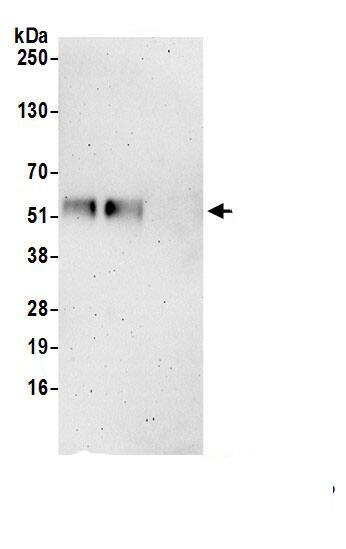 Immunoprecipitation:FAM126A AntibodyNBP3-29920] -Detection of human FAM126A by western blot of immunoprecipitates. Samples: Whole cell lysate (1.0 mg per IP reaction; 20% of IP loaded) from HeLa cells prepared using NETN lysis buffer. Antibodies: Affinity purified rabbit anti-FAM126A antibody (NBP3-29920 lot 1) used for IP at 6 µg per reaction. FAM126A was also immunoprecipitated by rabbit anti-FAM126A antibody BL22826. For blotting immunoprecipitated FAM126A, NBP3-29920 was used at 0.4 mg/ml. Detection: Chemiluminescence with an exposure time of 3 minutes.