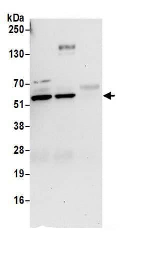 Immunoprecipitation:RUVBL1 AntibodyNBP3-29921] -Detection of human RUVBL1 by western blot of immunoprecipitates. Samples: Whole cell lysate (0.5 or 1.0 mg per IP reaction; 20% of IP loaded) from 293T cells prepared using NETN lysis buffer. Antibodies: Affinity purified rabbit anti-RUVBL1 antibody NBP3-29921 (lot NBP3-29921-1) used for IP at 6 µg per reaction. RUVBL1 was also immunoprecipitated by rabbit anti-RUVBL1.. For blotting immunoprecipitated RUVBL1, NBP3-29921 was used at 0.4 µg/ml. Detection: Chemiluminescence with an exposure time of 30 seconds.