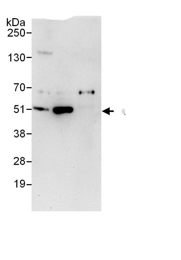 Immunoprecipitation:PSMD12 AntibodyNBP3-29923] -Detection of human PSMD12 by western blot of immunoprecipitates. Samples: Whole cell lysate (1 mg for IP, 20% of IP loaded) from HEK293T cells. Antibodies: Affinity purified rabbit anti-PSMD12 antibody NBP3-29923 used for IP at 6 µg/mg lysate. PSMD12 was less efficiently immunoprecipitated by rabbit anti-PSMD12., which recognizes an upstream epitope. For blotting immunoprecipitated PSMD12, A303-829A was used at 1 µg/ml. Detection: Chemiluminescence with an exposure time of 30 seconds.