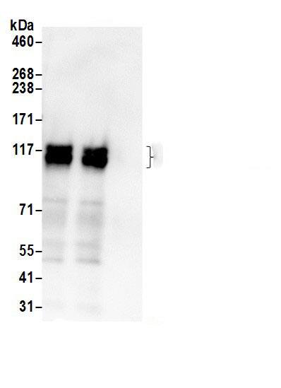 Immunoprecipitation:Calpastatin AntibodyNBP3-29926] -Detection of human Calpastatin/CAST by western blot of immunoprecipitates. Samples: Whole cell lysate (0.5 or 1.0 mg per IP reaction; 20% of IP loaded) from 293T cells prepared using NETN lysis buffer. Antibodies: Affinity purified rabbit anti-Calpastatin/CAST antibody NBP3-29926 (lot NBP3-29926-1) used for IP at 6 µg per reaction. Calpastatin/CAST was also immunoprecipitated by rabbit anti-Calpastatin/CAST.. For blotting immunoprecipitated Calpastatin/CAST, NBP3-29926 was used at 1 µg/ml. Detection: Chemiluminescence with an exposure time of 10 seconds.