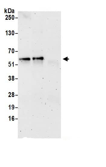 Immunoprecipitation:TBCE AntibodyNBP3-29929] -Detection of human TBCE by western blot of immunoprecipitates. Samples: Whole cell lysate (0.5 or 1.0 mg per IP reaction; 20% of IP loaded) from HeLa cells prepared using NETN lysis buffer. Antibodies: Affinity purified rabbit anti-TBCE antibody NBP3-29929 (lot NBP3-29929-1) used for IP at 6 µg per reaction. TBCE was also immunoprecipitated by rabbit anti-TBCE.. For blotting immunoprecipitated TBCE, NBP3-29929 was used at 1 µg/ml. Detection: Chemiluminescence with an exposure time of 3 minutes.