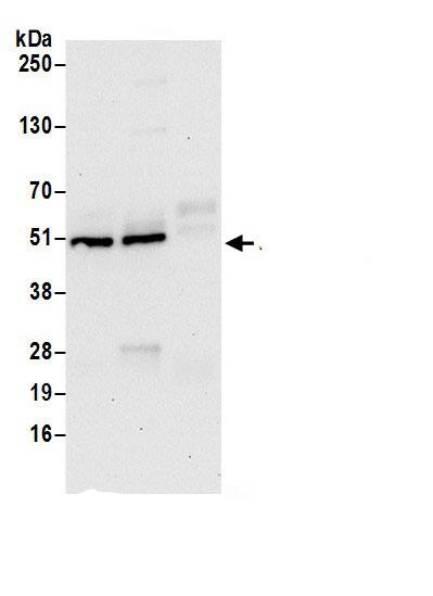 Immunoprecipitation:PRAF1 AntibodyNBP3-29931] -Detection of human POLR1E/PRAF1 by western blot of immunoprecipitates. Samples: Whole cell lysate (0.5 or 1.0 mg per IP reaction; 20% of IP loaded) from HeLa cells prepared using NETN lysis buffer. Antibody: Affinity purified rabbit anti-POLR1E/PRAF1 antibody NBP3-29931 (lot NBP3-29931-1) used for IP at 6 µg per reaction. POLR1E/PRAF1 was also immunoprecipitated by rabbit anti-POLR1E/PRAF1.. For blotting immunoprecipitated POLR1E/PRAF1, NBP3-29931 was used at 1 µg/ml. Detection: Chemiluminescence with an exposure time of 30 seconds.