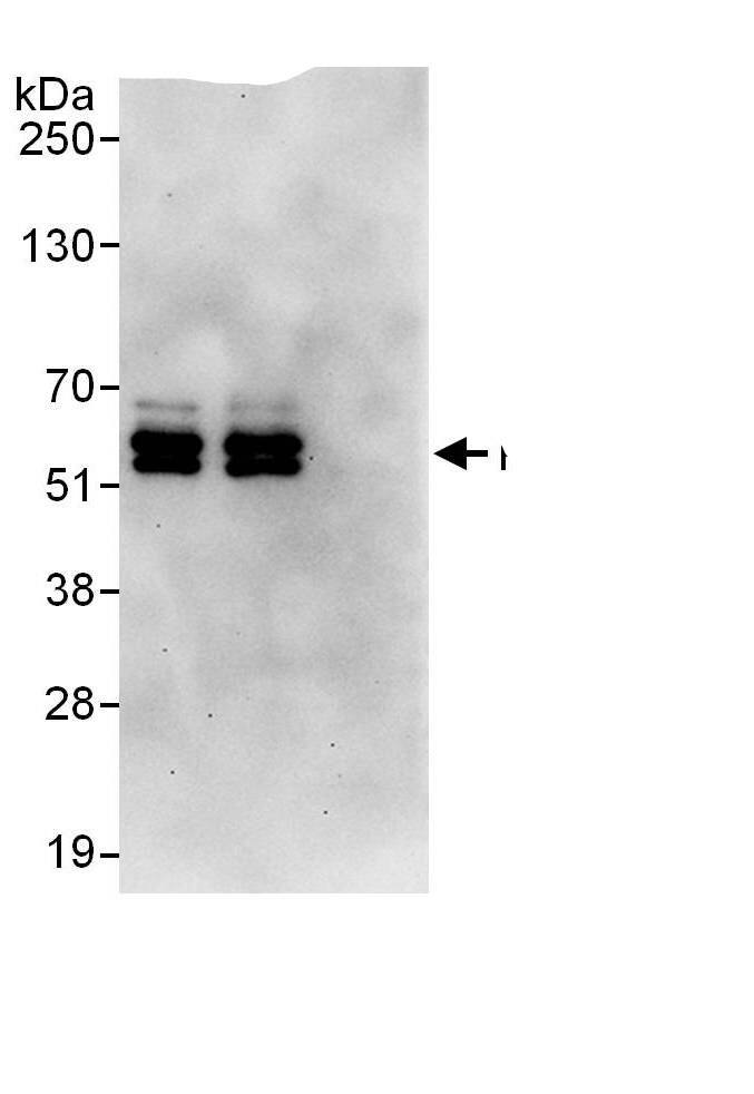 Immunoprecipitation:PPP2R5C AntibodyNBP3-29933] -Detection of human PPP2R5C by western blot of immunoprecipitates. Samples: Whole cell lysate (1 mg for IP, 20% of IP loaded) from HEK293T cells. Antibodies: Affinity purified rabbit anti-PPP2R5C antibody NBP3-29933 used for IP at 6 µg/mg lysate. PPP2R5C was also immunoprecipitated by rabbit anti-PPP2R5C., which recognizes a downstream epitope. For blotting immunoprecipitated PPP2R5C, was used at 1 µg/ml. Detection: Chemiluminescence with an exposure time of 30 seconds.