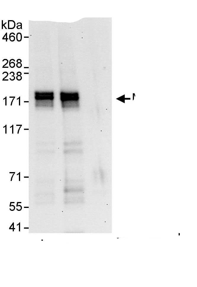 Immunoprecipitation:MTUS1 AntibodyNBP3-29934] -Detection of human MTUS1 by western blot of immunoprecipitates. Samples: Whole cell lysate (1 mg for IP, 20% of IP loaded) from HeLa cells. Antibodies: Affinity purified rabbit anti-MTUS1 antibody NBP3-29934 used for IP at 3 µg/mg lysate. MTUS1 was also immunoprecipitated by rabbit anti-MTUS1., which recognizes a downstream epitope. For blotting immunoprecipitated MTUS1,  was used at 1 µg/ml. Detection: Chemiluminescence with an exposure time of 30 seconds.