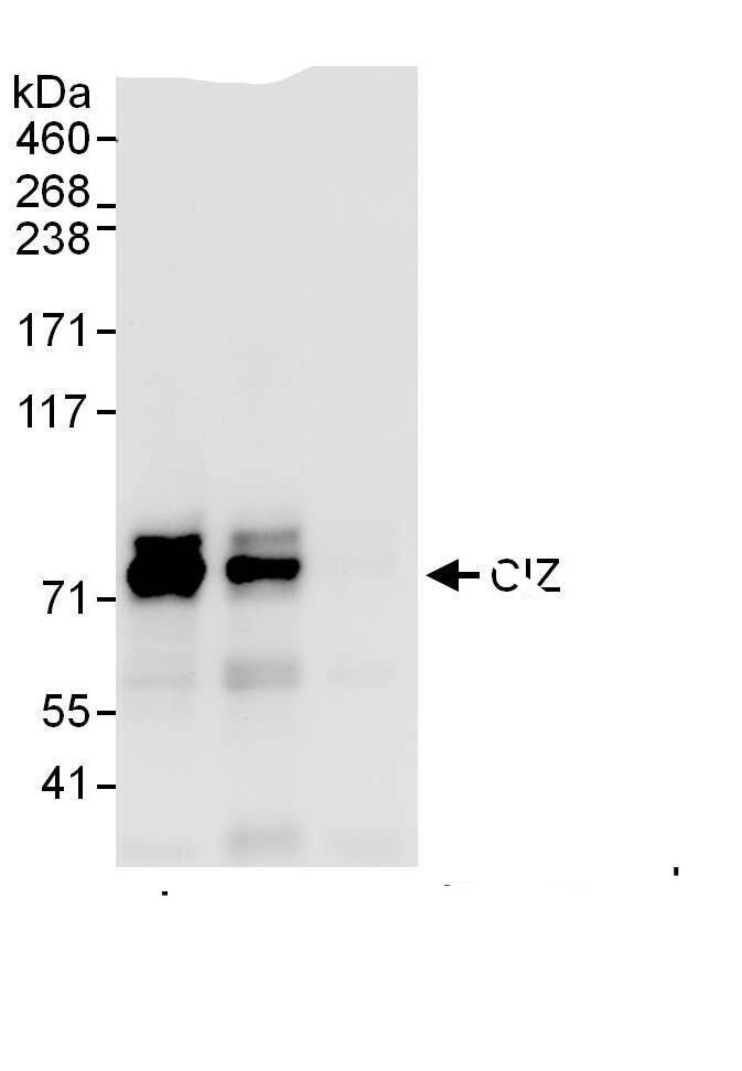 Immunoprecipitation:ZNF384 AntibodyNBP3-29935] -Detection of human CIZ by western blot of immunoprecipitates. Samples: Whole cell lysate (1 mg for IP, 20% of IP loaded) from HeLa cells. Antibodies: Affinity purified rabbit anti-CIZ antibody NBP3-29935 used for IP at 6 µg/mg lysate. CIZ was also immunoprecipitated by rabbit anti-CIZ., which recognizes a downstream epitope. For blotting immunoprecipitated CIZ,  was used at 0.4 µg/ml. Detection: Chemiluminescence with an exposure time of 10 seconds.