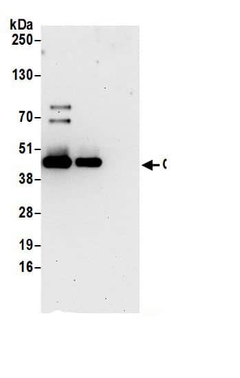 Immunoprecipitation:OAT AntibodyNBP3-29936] -Detection of human OAT by western blot of immunoprecipitates. Samples: Whole cell lysate (0.5 or 1.0 mg per IP reaction; 20% of IP loaded) from 293T cells prepared using NETN lysis buffer. Antibodies: Affinity purified rabbit anti-OAT antibody NBP3-29936 (lot NBP3-29936-1) used for IP at 6 µg per reaction. OAT was also immunoprecipitated by rabbit anti-OAT antibody BL21203. For blotting immunoprecipitated OAT, NBP3-29936 was used at 0.4 µg/ml. Detection: Chemiluminescence with an exposure time of 30 seconds.