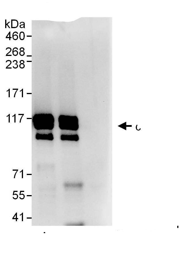 Immunoprecipitation:SKI AntibodyNBP3-29937] -Detection of human c-Ski by western blot of immunoprecipitates. Samples: Whole cell lysate (1 mg for IP, 20% of IP loaded) from HEK293T cells. Antibodies: Affinity purified rabbit anti-c-Ski antibody NBP3-29937 used for IP at 6 µg/mg lysate. c-Ski was also immunoprecipitated by rabbit anti-c-Ski., which recognizes a downstream epitope. For blotting immunoprecipitated c-Ski, A303-518A was used at 1 µg/ml. Detection: Chemiluminescence with an exposure time of 10 seconds.