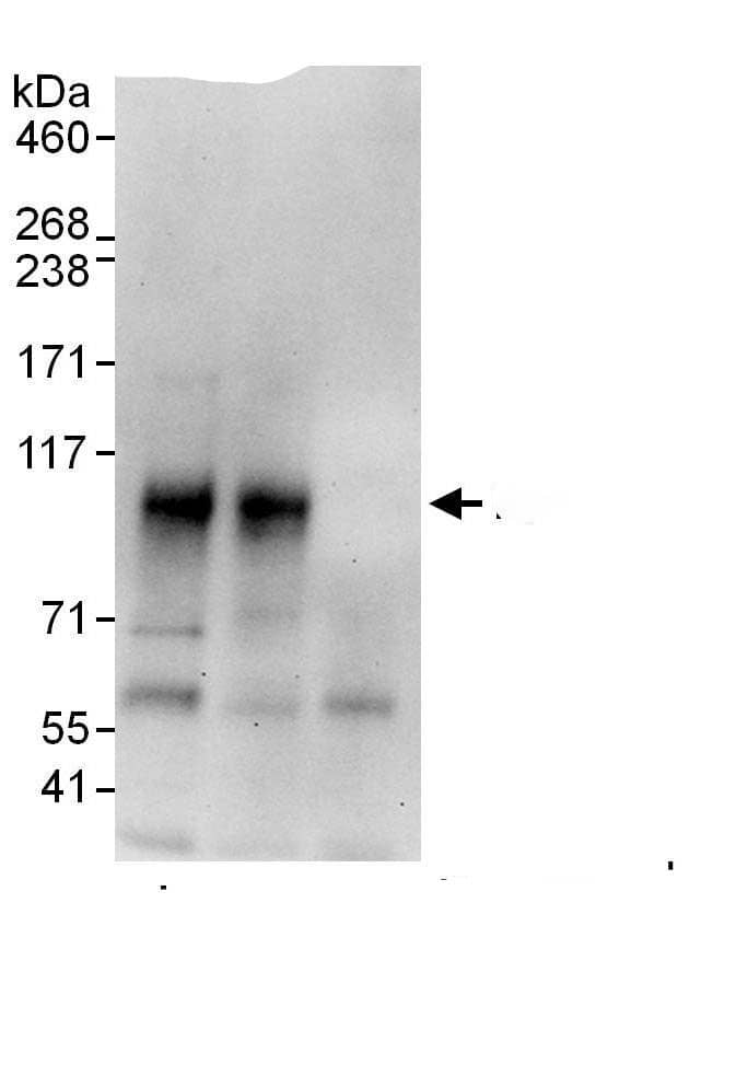 Immunoprecipitation:RANK/TNFRSF11A AntibodyNBP3-29939] -Detection of human RANK by western blot of immunoprecipitates. Samples: Whole cell lysate (1 mg for IP, 20% of IP loaded) from HEK293T cells. Antibodies: Affinity purified rabbit anti-RANK antibody NBP3-29939 used for IP at 6 µg/mg lysate. RANK was also immunoprecipitated by rabbit anti-RANK., which recognizes an upstream epitope. For blotting immunoprecipitated RANK,  was used at 1 µg/ml. Detection: Chemiluminescence with an exposure time of 30 seconds.