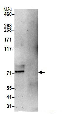 Immunoprecipitation:Proprotein Convertase 9/PCSK9 AntibodyNBP3-29941] -Detection of human PCSK9 by western blot of immunoprecipitates. Samples: Whole cell lysate (0.5 or 1.0 mg per IP reaction; 20% of IP loaded) from 293T cells prepared using NETN lysis buffer. Antibodies: Affinity purified rabbit anti-PCSK9 antibody NBP3-29941 (lot NBP3-29941-1) used for IP at 6 µg per reaction. For blotting immunoprecipitated PCSK9, NBP3-29941 was used at 1 µg/ml. Detection: Chemiluminescence with an exposure time of 3 minutes.