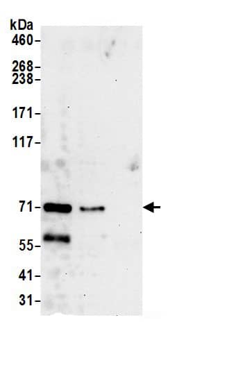 Immunoprecipitation:NGLY1 AntibodyNBP3-29942] -Detection of human NGLY1 by western blot of immunoprecipitates. Samples: Whole cell lysate (0.5 or 1.0 mg per IP reaction; 20% of IP loaded) from 293T cells prepared using NETN lysis buffer. Antibodies: Affinity purified rabbit anti-NGLY1 antibody NBP3-29942 (lot NBP3-29942-1) used for IP at 6 µg per reaction. NGLY1 was also immunoprecipitated by rabbit anti-NGLY1 antibody BL21982. For blotting immunoprecipitated NGLY1, NBP3-29942 was used at 0.4 µg/ml. Detection: Chemiluminescence with an exposure time of 30 seconds.