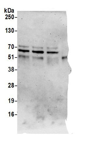 Immunoprecipitation:SPATS2L AntibodyNBP3-29943] -Detection of human SPATS2L by western blot of immunoprecipitates. Samples: Whole cell lysate (0.5 or 1.0 mg per IP reaction; 20% of IP loaded) from 293T cells prepared using NETN lysis buffer. Antibodies: Affinity purified rabbit anti-SPATS2L antibody NBP3-29943 (lot NBP3-29943-1) used for IP at 6 µg per reaction. SPATS2L was also immunoprecipitated by rabbit anti-SPATS2L antibodies . For blotting immunoprecipitated SPATS2L, A305-118A was used at 0.1 µg/ml. Detection: Chemiluminescence with an exposure time of 3 minutes.