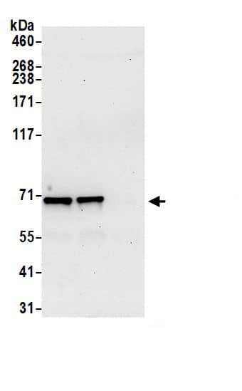 Immunoprecipitation:ATP6V1A AntibodyNBP3-29944] -Detection of human ATP6V1A by western blot of immunoprecipitates. Samples: Whole cell lysate (0.5 or 1.0 mg per IP reaction; 20% of IP loaded) from 293T cells prepared using NETN lysis buffer. Antibodies: Affinity purified rabbit anti-ATP6V1A antibody NBP3-29944 (lot NBP3-29944-1) used for IP at 6 µg per reaction. ATP6V1A was also immunoprecipitated by rabbit anti-ATP6V1A.. For blotting immunoprecipitated ATP6V1A, NBP3-29944 was used at 1 µg/ml. Detection: Chemiluminescence with an exposure time of 30 seconds.