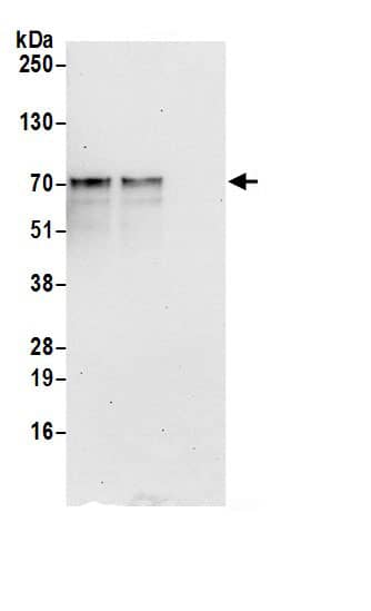 Immunoprecipitation:RPUSD2 AntibodyNBP3-29945] -Detection of human RPUSD2 by western blot of immunoprecipitates. Samples: Whole cell lysate (0.5 or 1.0 mg per IP reaction; 20% of IP loaded) from HeLa (15µg) cells prepared using NETN lysis buffer. Antibodies: Affinity purified rabbit anti-RPUSD2 antibody NBP3-29945 (lot NBP3-29945-1) used for IP at 6 µg per reaction. RPUSD2 was also immunoprecipitated by rabbit anti-RPUSD2.. For blotting immunoprecipitated RPUSD2, NBP3-29945 was used at 1 µg/ml. Detection: Chemiluminescence with an exposure time of 30 seconds.