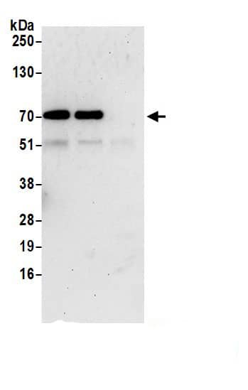 Immunoprecipitation:KLHDC5 AntibodyNBP3-29946] -Detection of human KLHL42 by western blot of immunoprecipitates. Samples: Whole cell lysate (0.5 or 1.0 mg per IP reaction; 20% of IP loaded) from 293T cells prepared using NETN lysis buffer. Antibodies: Affinity purified rabbit anti-KLHL42 antibody (NBP3-29946 lot 1) used for IP at 6 µg per reaction. KLHL42 was also immunoprecipitated by rabbit anti-KLHL42.. For blotting immunoprecipitated KLHL42, NBP3-29946 was used at 0.4 mg/ml. Detection: Chemiluminescence with an exposure time of 30 seconds.