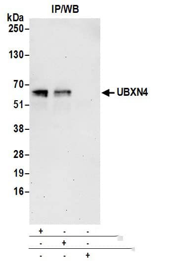 Immunoprecipitation:[NBP3-29947]-Detection of human UBXN4 by western blot of immunoprecipitates. Samples: Whole cell lysate from 293T cells prepared using NETN lysis buffer. Antibodies: Affinity purified rabbit anti-UBXN4 antibody used for IP at 6 µg per reaction. UBXN4 was also immunoprecipitated by rabbit anti-UBXN4 antibody. For blotting immunoprecipitated UBXN4, was used at 0. 4 mg/ml0. Detection: Chemiluminescence with an exposure time of 30 seconds.