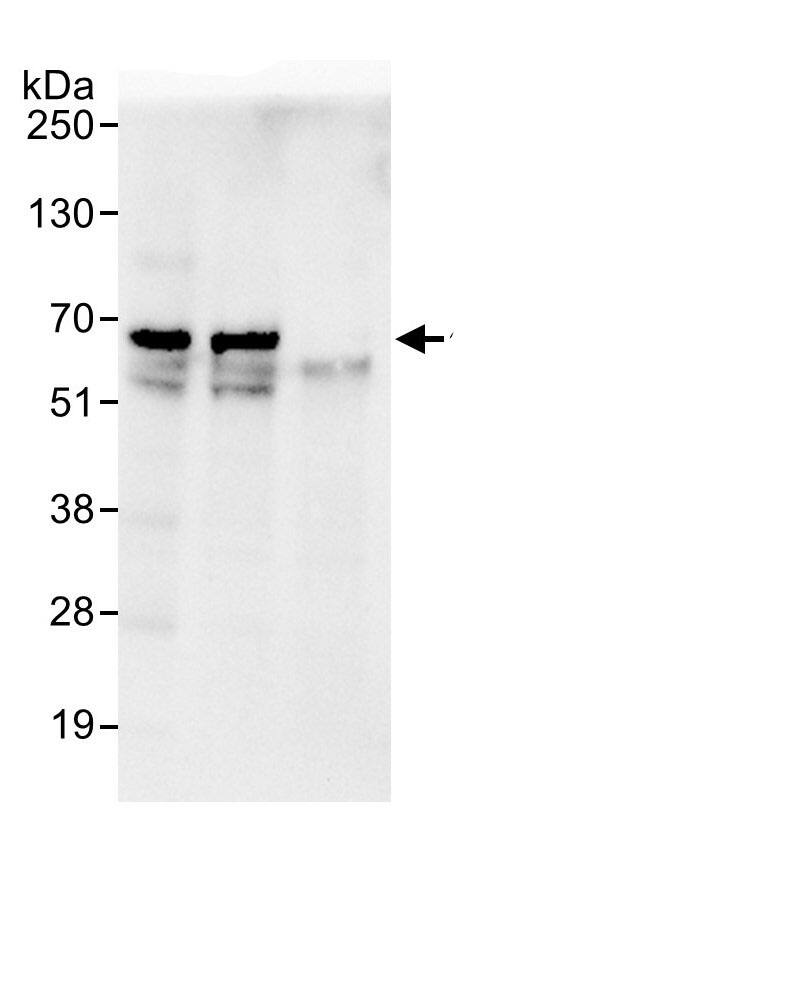 Immunoprecipitation:eIF2B4 AntibodyNBP3-29948] -Detection of human eIF2B delta/EIF2B4 by western blot of immunoprecipitates. Samples: Whole cell lysate (1 mg for IP, 20% of IP loaded) from HeLa cells. Antibodies: Affinity purified rabbit anti-eIF2B delta/EIF2B4 antibody NBP3-29948 used for IP at 6 µg/mg lysate. eIF2B delta/EIF2B4 was also immunoprecipitated by rabbit anti-eIF2B delta/EIF2B4., which recognizes an upstream epitope. For blotting immunoprecipitated eIF2B delta/EIF2B4, A302-982A was used at 0.4 µg/ml. Detection: Chemiluminescence with an exposure time of 10 seconds.