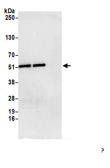 Immunoprecipitation:AGPAT7 AntibodyNBP3-29949] -Detection of human LPCAT4 by western blot of immunoprecipitates. Samples: Whole cell lysate (1.0 mg per IP reaction; 20% of IP loaded) from HeLa cells prepared using NETN lysis buffer. Antibodies: Affinity purified rabbit anti-LPCAT4 antibody (NBP3-29949 lot 1) used for IP at 6 µg per reaction. LPCAT4 was also immunoprecipitated by rabbit anti-LPCAT4 antibody for blotting immunoprecipitated LPCAT4, NBP3-29949 was used at 0.4 mg/ml. Detection: Chemiluminescence with an exposure time of 3 minutes.