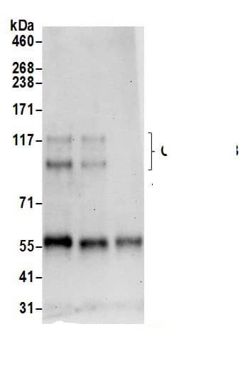 Immunoprecipitation:Cadherin-13 AntibodyNBP3-29952] -Detection of human Cadherin 13 by western blot of immunoprecipitates. Samples: Whole cell lysate (0.5 or 1.0 mg per IP reaction; 20% of IP loaded) from HeLa cells prepared using NETN lysis buffer. Antibodies: Affinity purified rabbit anti-Cadherin 13 antibody NBP3-29952 (lot NBP3-29952-1) used for IP at 6 µg per reaction. Cadherin 13 was also immunoprecipitated by rabbit anti-Cadherin 13 antibody BL19625. For blotting immunoprecipitated Cadherin 13, NBP3-29952 was used at 0.4 µg/ml. Detection: Chemiluminescence with an exposure time of 30 seconds.