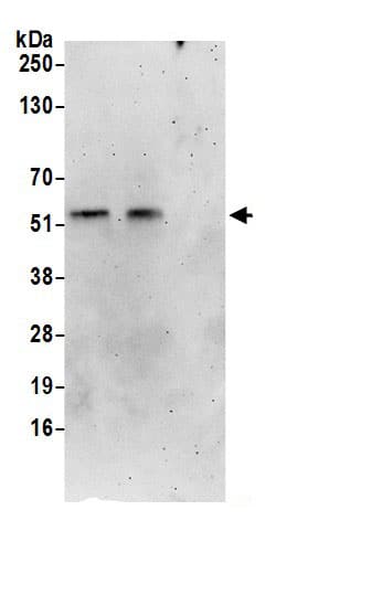 Immunoprecipitation:PMPCA AntibodyNBP3-29953] -Detection of human PMPCA by western blot of immunoprecipitates. Samples: Whole cell lysate (0.5 or 1.0 mg per IP reaction; 20% of IP loaded) from 293T cells prepared using NETN lysis buffer. Antibodies: Affinity purified rabbit anti-PMPCA antibody NBP3-29953 (lot NBP3-29953-1) used for IP at 6 µg per reaction. PMPCA was also immunoprecipitated by rabbit anti-PMPCA.. For blotting immunoprecipitated PMPCA, NBP3-29953 was used at 1 µg/ml. Detection: Chemiluminescence with an exposure time of 3 minutes.